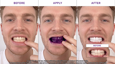 Lumora Teeth Whitening Strips | Coconut Flavor